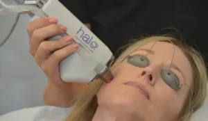Halo Laser Skin Treatment in Portage & St. Joseph, MI