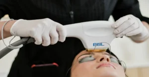 BBL Laser Hair Removal in Portage & St. Joseph, MI