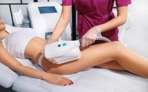 CoolSculpting in Portage, MI